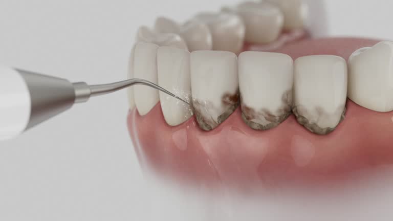 Trusted Tooth Extraction service in Greenbrier, TN - Dentist Open Now